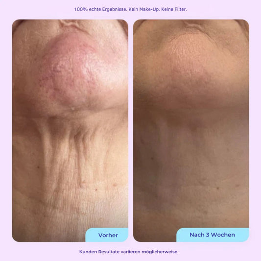 DermaSil Hals-Pad