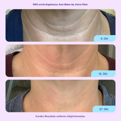 Aloreva DermaSil Pad
