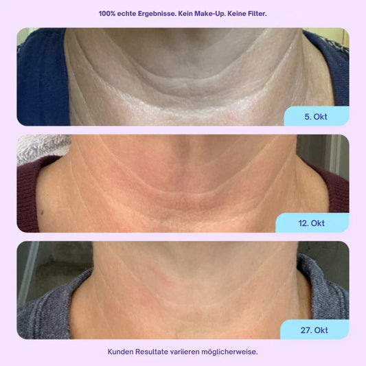 Aloreva DermaSil Pad