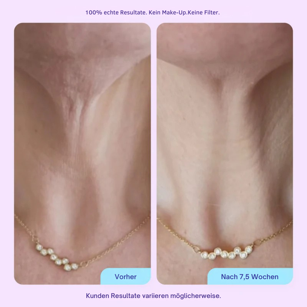 Aloreva NeckLift+