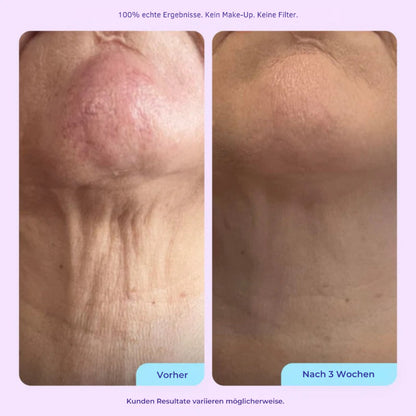 Aloreva DermaSil Pad